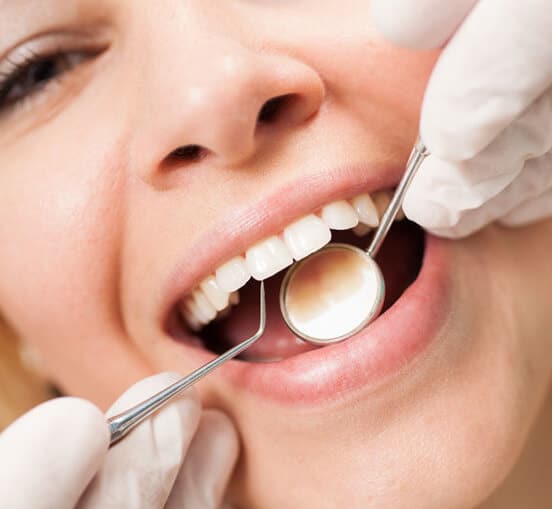 The Cleanest Your Teeth Can Be - Dental Cleaning Houston