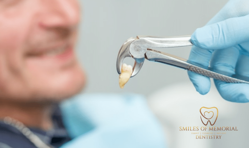 When Is Tooth Extraction Required