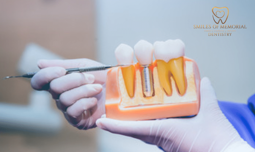 who is a good candidate for dental implants