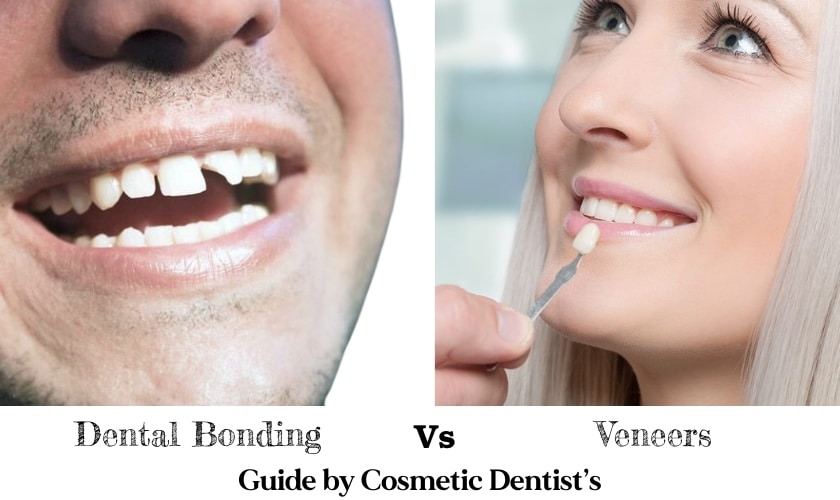 Our cosmetic dentist guideline, that which one is the best option for you