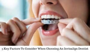 Image of 5 key factors to consider when choosing an invisalign dentist
