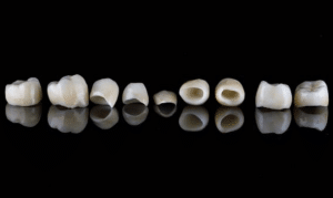 What Are The Common Misconception About Dental Crowns